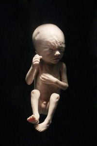 feto de 24 semanas