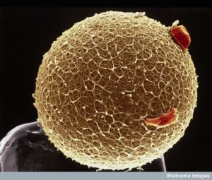 B0002100 Human egg with coronal cells - gold